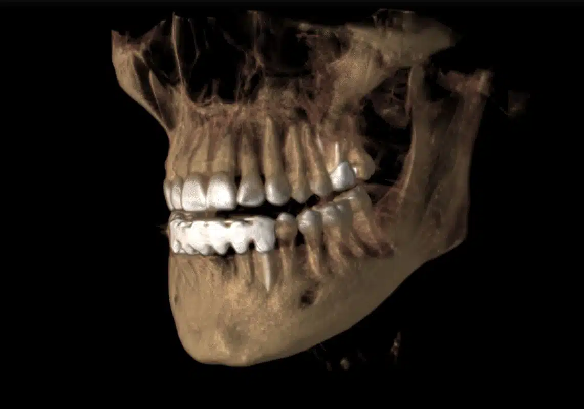 3D Image - Preferred Dental