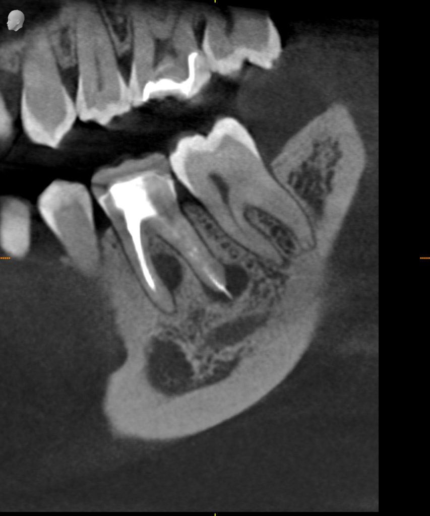 3D Longitudinal Image - Preferred Dental