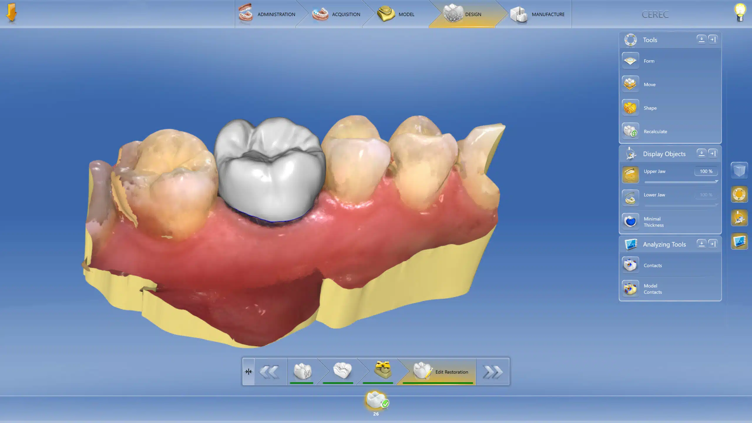 CEREC® One-Visit Dentistry Image - Preferred Dental