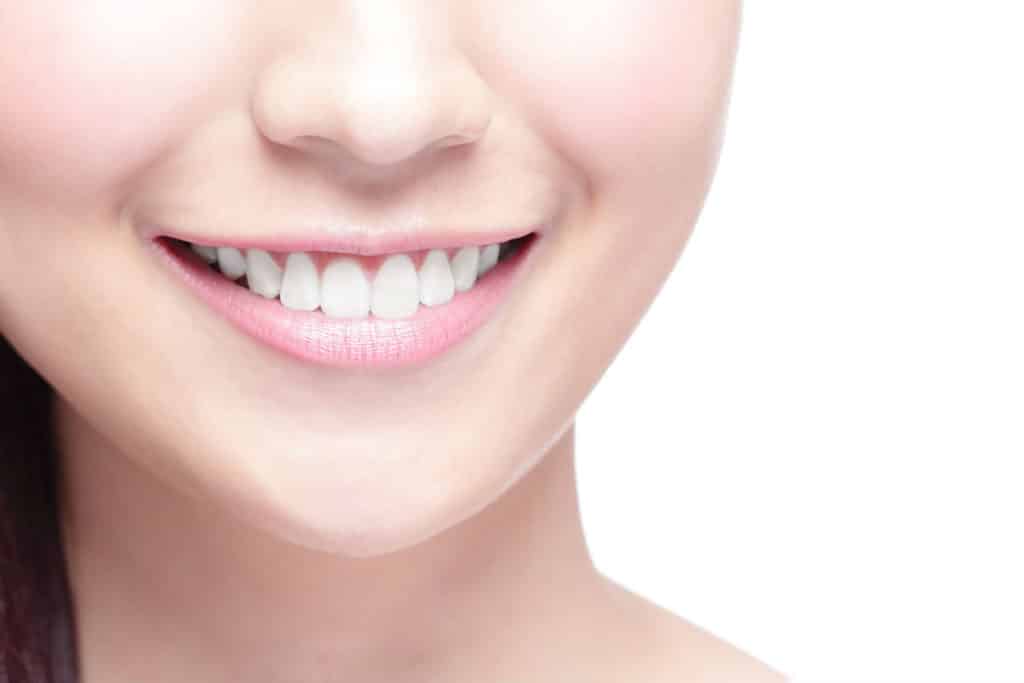 Woman Smiling Image - Preferred Dental